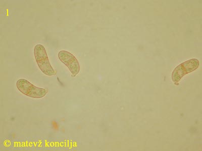 Dacrymyces tortus - Sporen