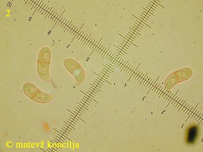 Dacrymyces tortus - Sporen