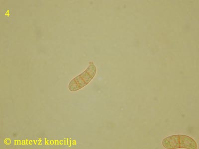 Dacrymyces tortus - Sporen