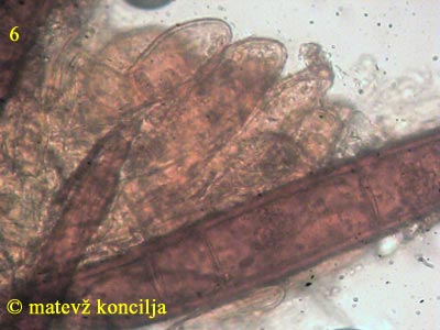 Scutellinia trechispora - Haare