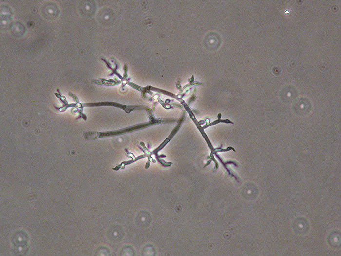 Trichoderma sp.