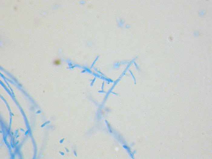 Trichophyton tonsurans