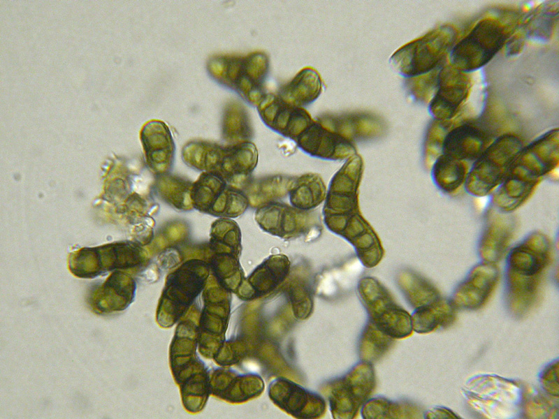 Trimmatostroma salicis