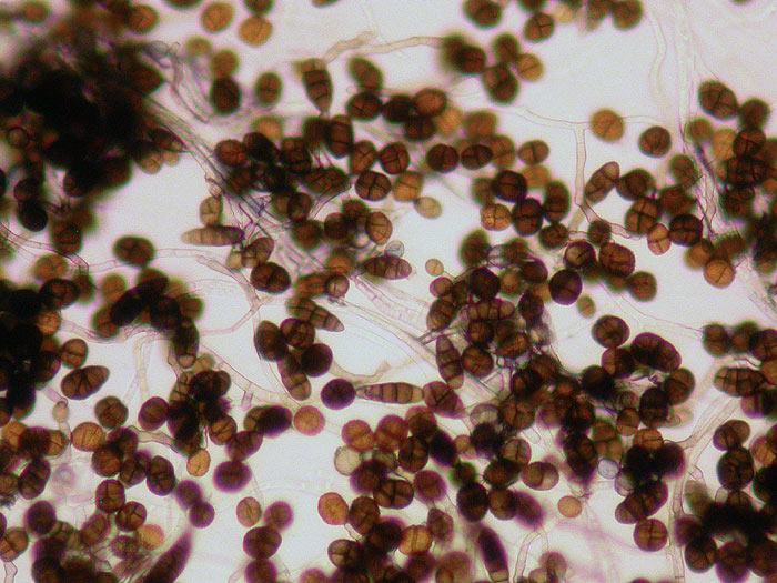 Ulocladium sp.