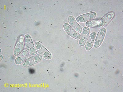 Phaeohelotium umbilicatum - Sporen