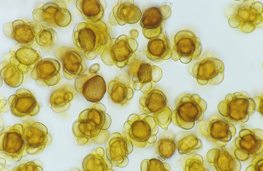 Urocystis colchici