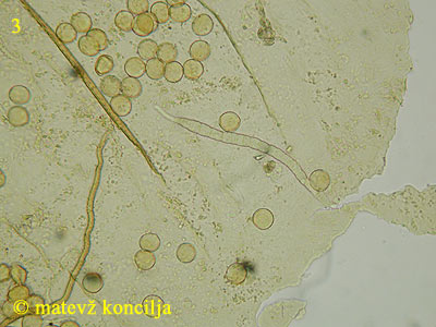 Trichia varia - peridium
