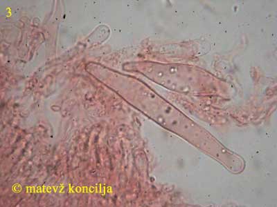 flammulina velutipes - kajlocistide
