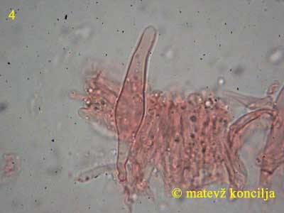 flammulina velutipes - kajlocistide