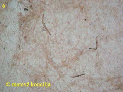 flammulina velutipes - dermatocistide