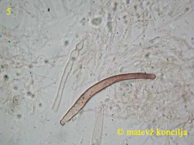 flammulina velutipes - dermatocistide
