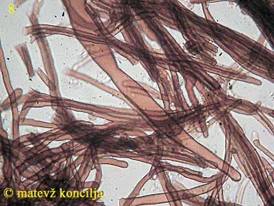 flammulina velutipes - kaulocistide