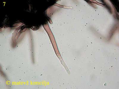 flammulina velutipes - kaulocistide