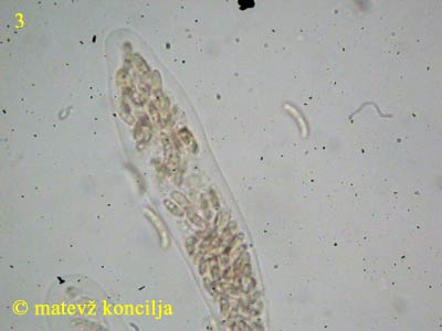 Diatrypella verrucaeformis - Ascus