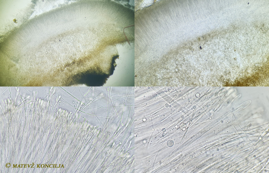 Vibrissea-flavovirens - Gelbr&uuml;nes Kranzbecherchen