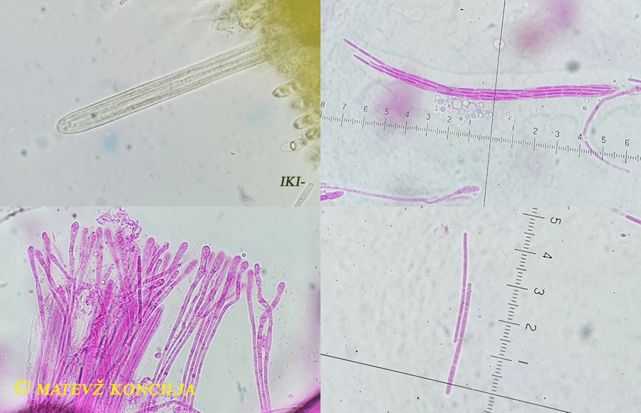 Vibrissea-flavovirens - Gelbr&uuml;nes Kranzbecherchen