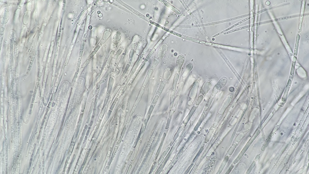 Vibrissea-flavovirens - Gelbr&uuml;nes Kranzbecherchen