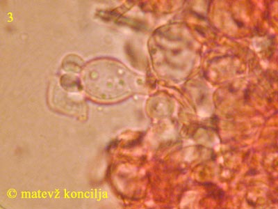 Tulasnella violea - Basidie