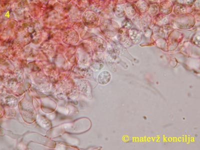 Tulasnella violea - Basidien