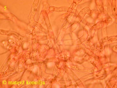 Tulasnella violea - Hyphen