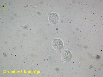 Tulasnella violea - Sporen