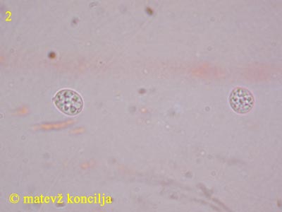 Tulasnella violea - Sporen