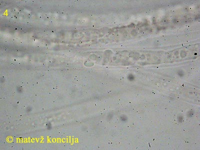 Hypomyces viridis - aski