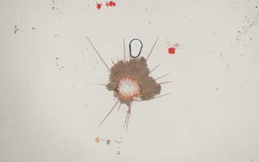 Volutella ciliata