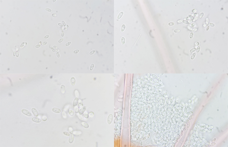Volutella ciliata