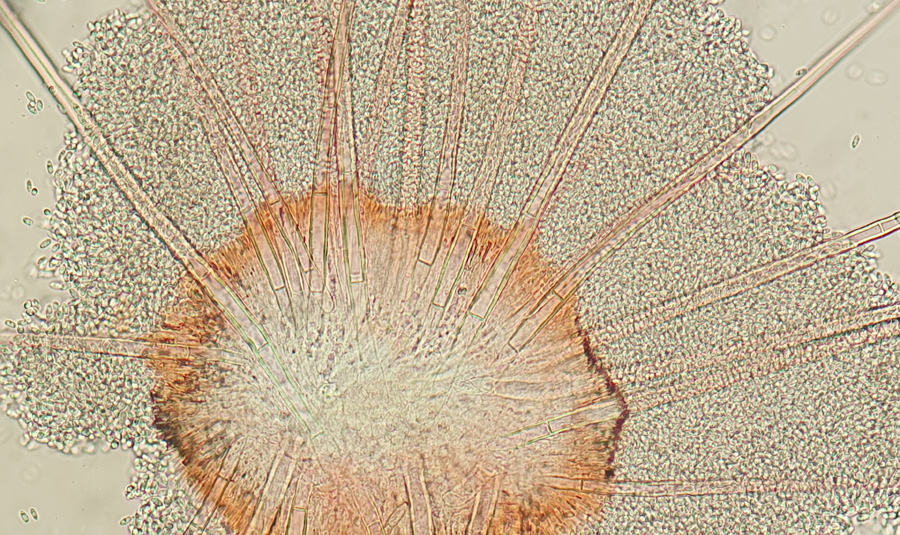 Volutella ciliata
