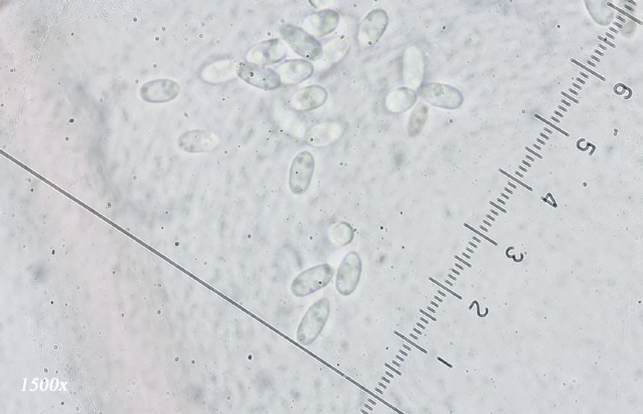 Volutella ciliata
