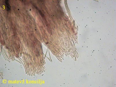Lachnellula willkommii - Paraphysen