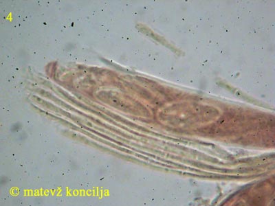 Lachnellula willkommii - Paraphysen