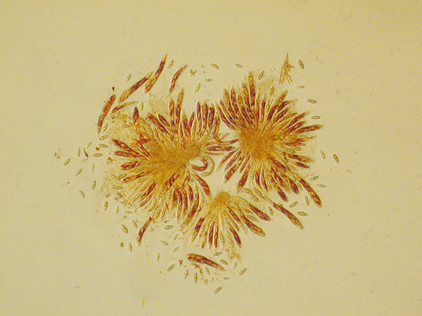 Asteromassaria macrospora