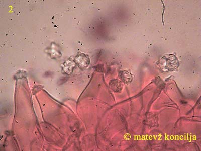 inocybe asterospora - kajlocistide