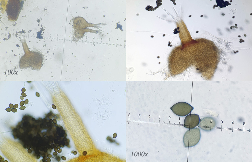 Melanospora zamiae