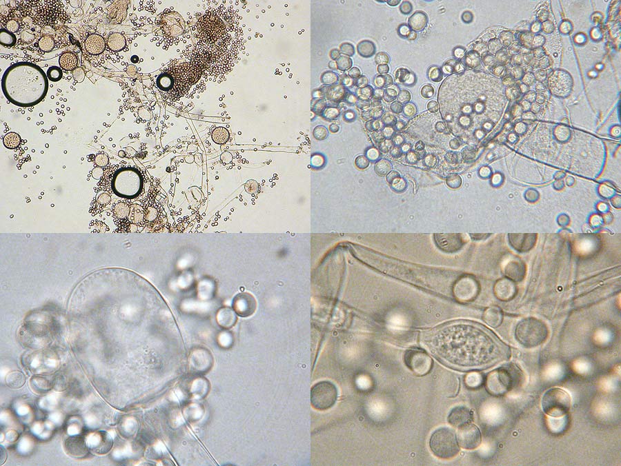 Обнаружены споры и мицелий. Мукор микроскопирование. Мицелий гриба микроскопия. Мицелий грибов микроскопия. Мукор в чашке Петри.