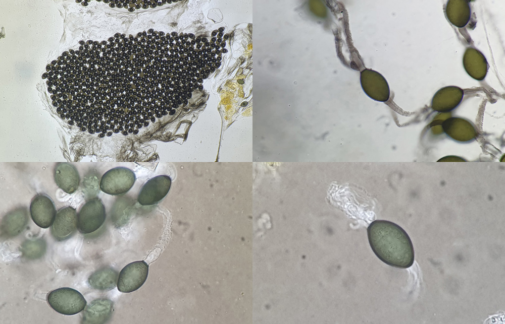 Podospora granulostriata