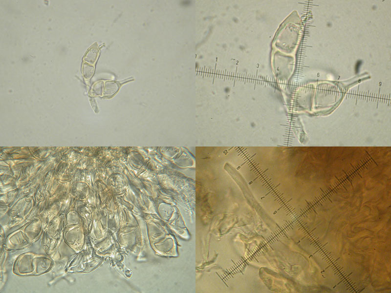 Puccinia salviae