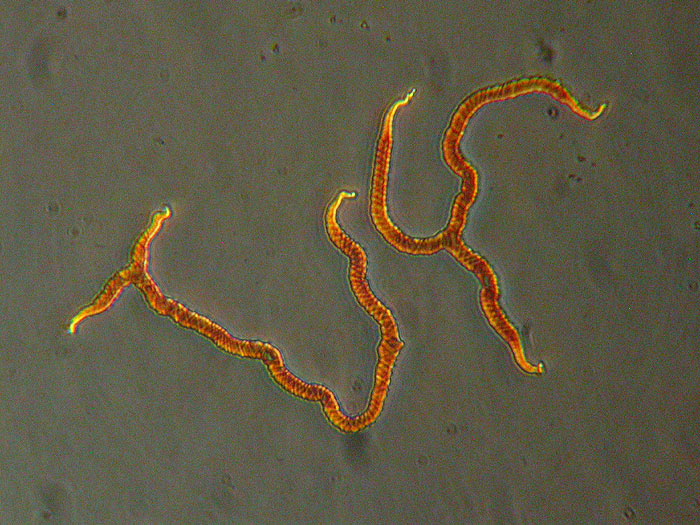 Trichia contorta