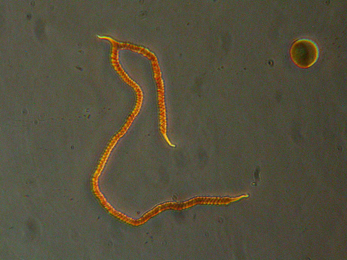 Trichia contorta