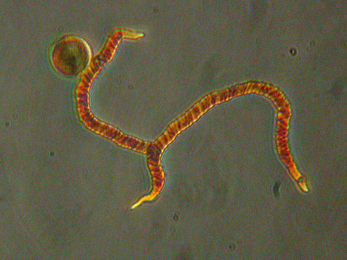 Trichia contorta